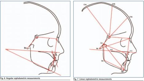 Cranial Measurments